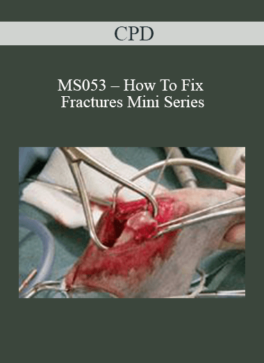 CPD - MS053 – How To Fix Fractures Mini Series