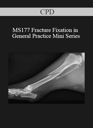 CPD - MS177 Fracture Fixation in General Practice Mini Series