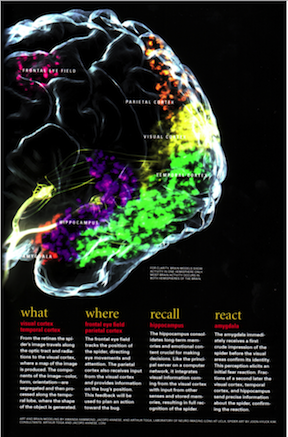 BRAINSCAN