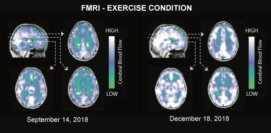 exercise before and after | eSy[GB]